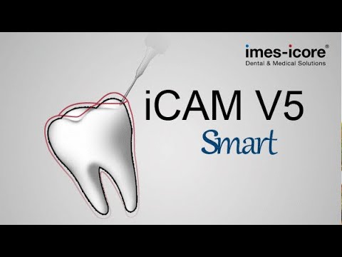 iCAM V5 dental CAM milling software