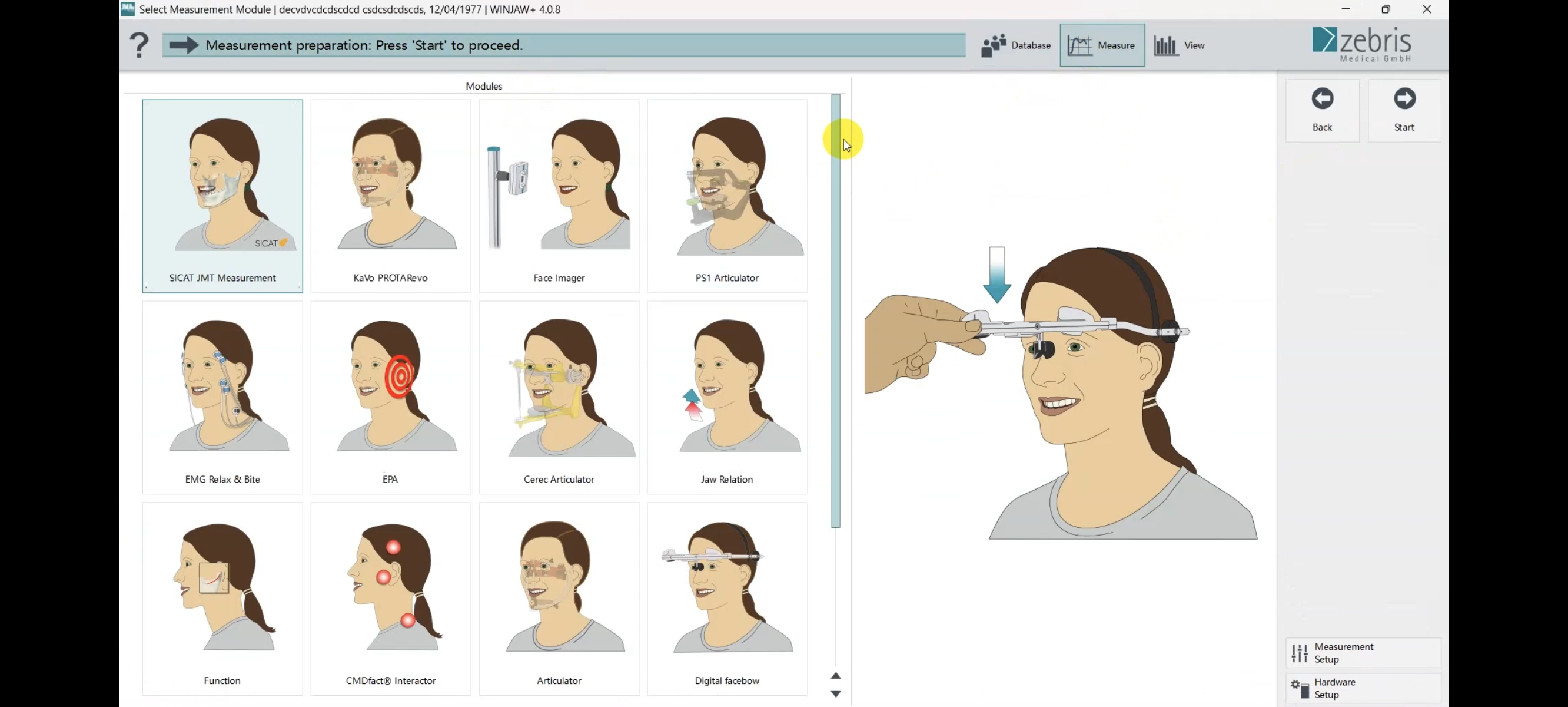 Zebris WinJaw jaw motion analysis software