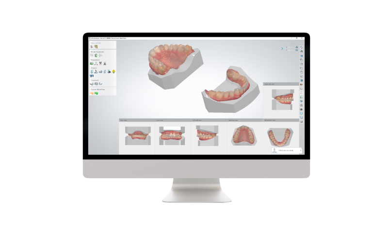 3Shape Ortho System