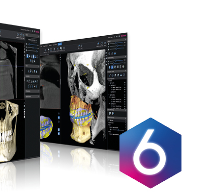 Romexis 6 Planmeca dental imaging software