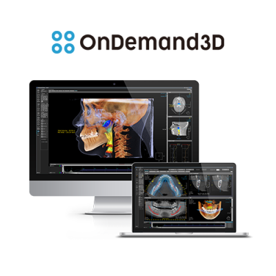 OnDemand3D dental CBCT imaging software